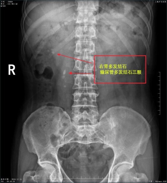 图文图片