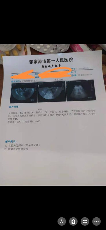 圖文圖片