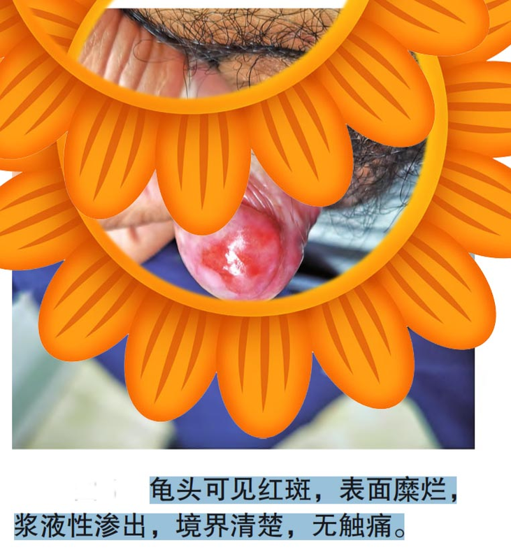 圖文圖片