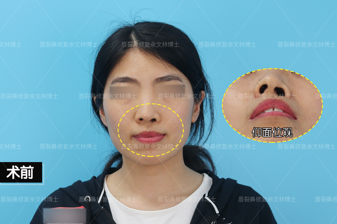 圖文圖片