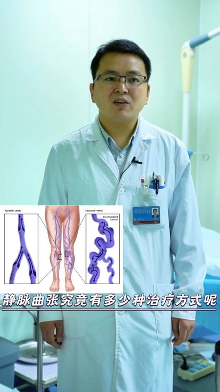 得了静脉曲张怎么办？
                    有什么好的治疗方法么？