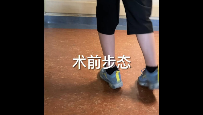 显微外科技术下的脑瘫患者的下肢功能重建术前术后步态对比