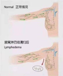 圖文圖片