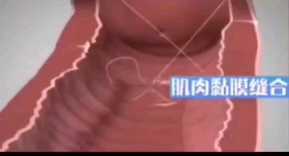 視頻封面