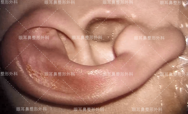 圖文圖片