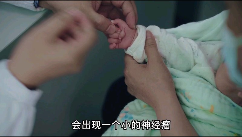 漂浮赘生指的手术难度并不高，但却不能一刀割掉，要处理得当