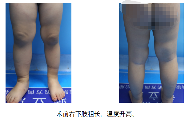 圖文圖片
