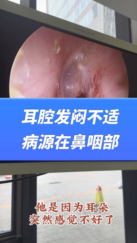 視頻封面