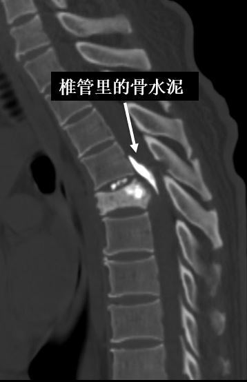圖文圖片