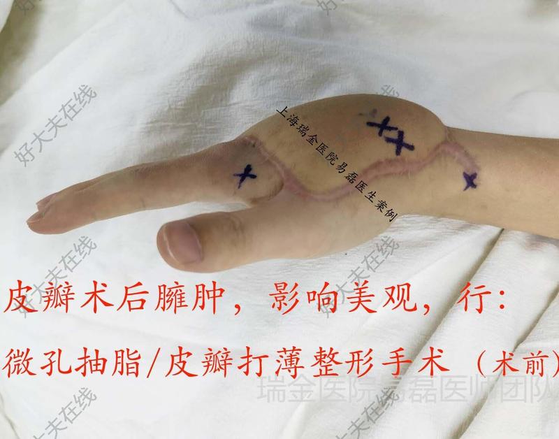 圖文圖片