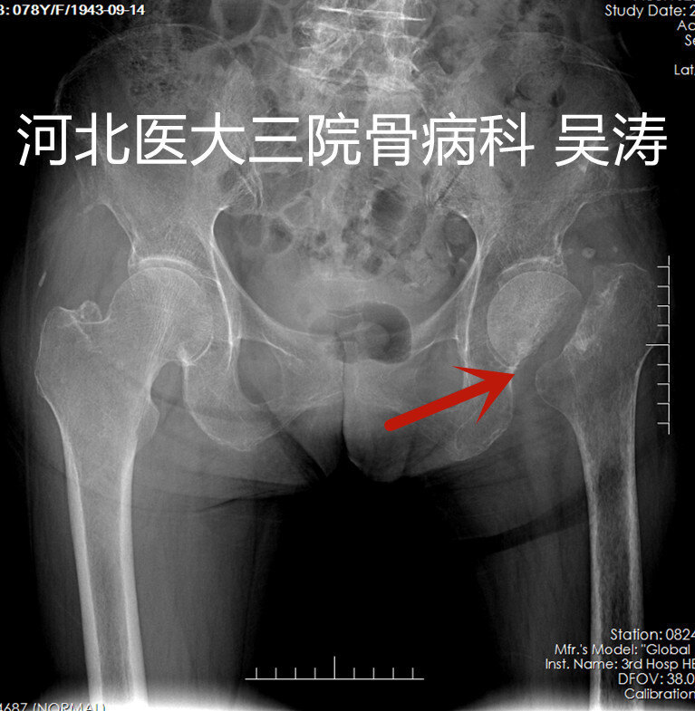 圖文圖片