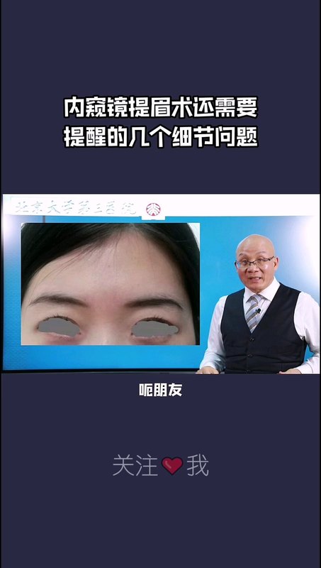 内窥镜提眉还需要提醒的几个细节问题