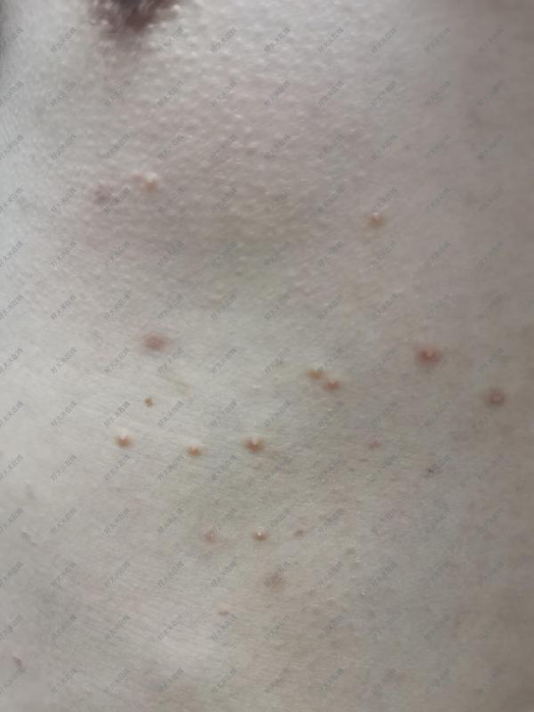 圖文圖片