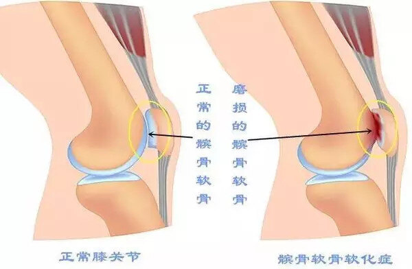 圖文圖片