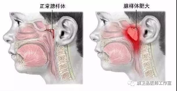 圖文圖片