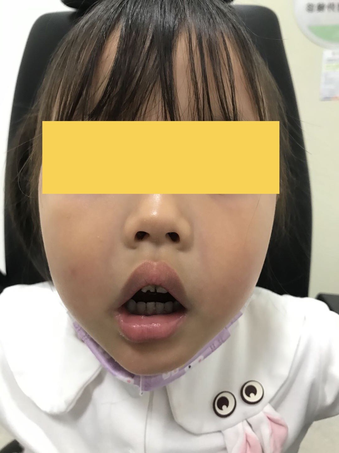 圖文圖片