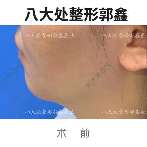 圖文圖片