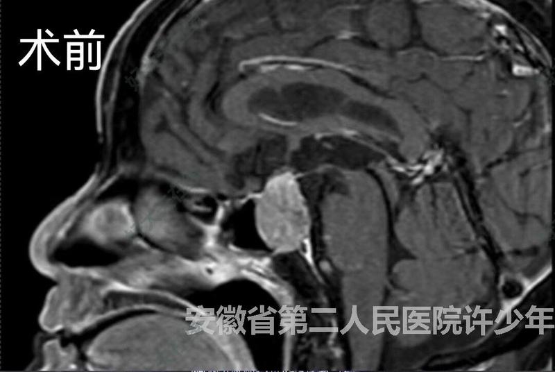圖文圖片