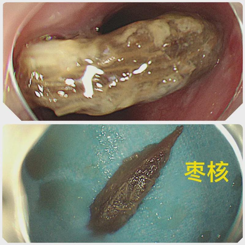 圖文圖片