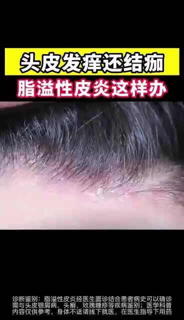 視頻封面