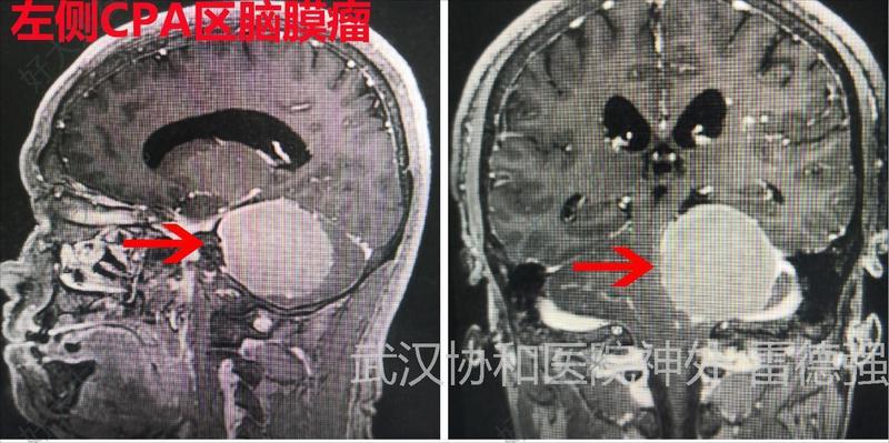 圖文圖片