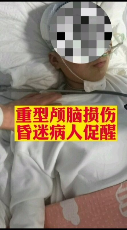 重型颅脑损伤昏迷促醒之路