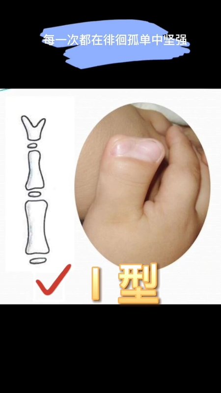 視頻封面