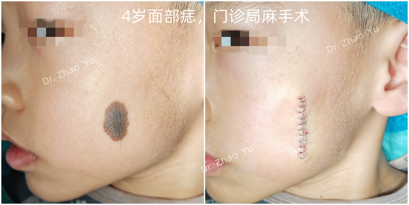 圖文圖片