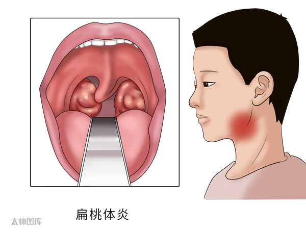 圖片