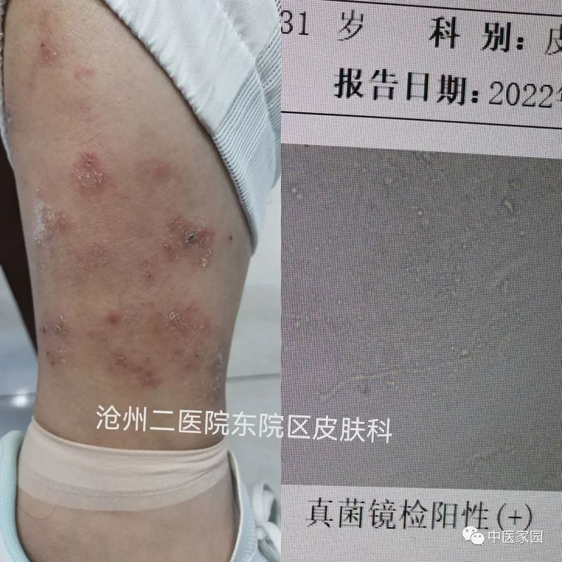 圖文圖片