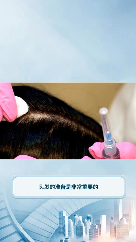 面部拉皱手术如何准备头发