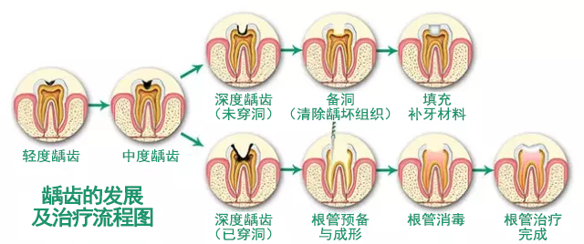 圖文圖片