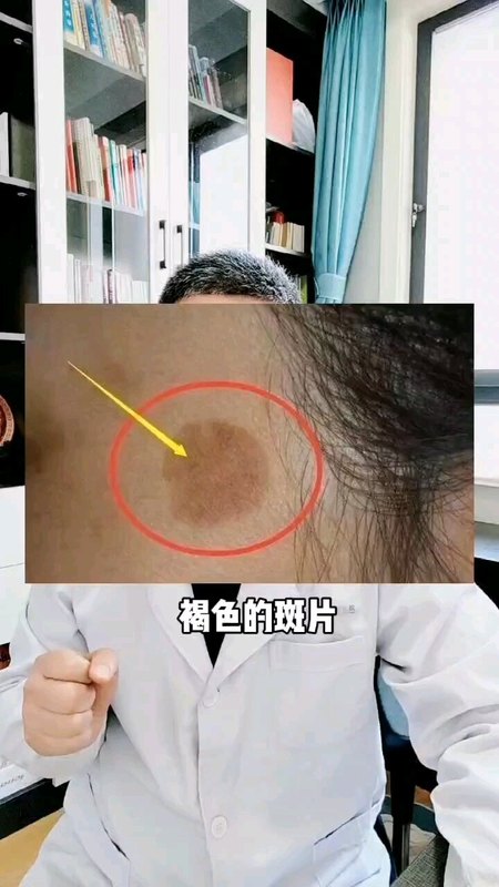 視頻封面