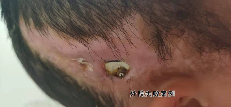 圖文圖片