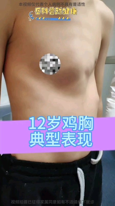 視頻封面