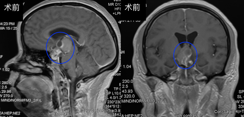 圖文圖片