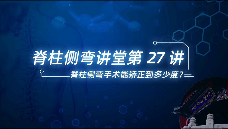 【脊柱侧弯讲堂】第27讲：脊柱侧弯手术能矫正到多少度？