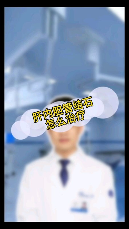 肝内胆管结石怎么治疗
