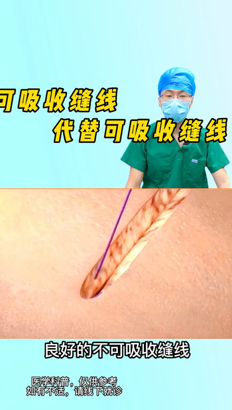筋膜悬吊很安全
