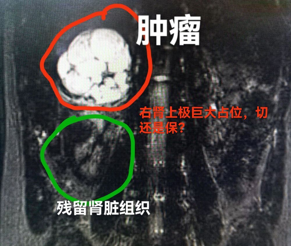 圖文圖片