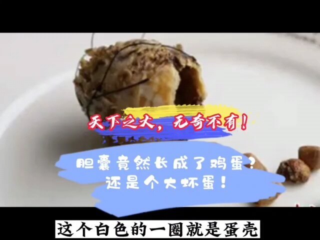 胆囊变鸡蛋？还是个坏蛋？