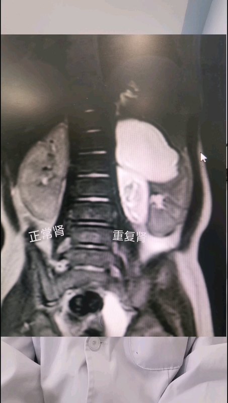 視頻封面