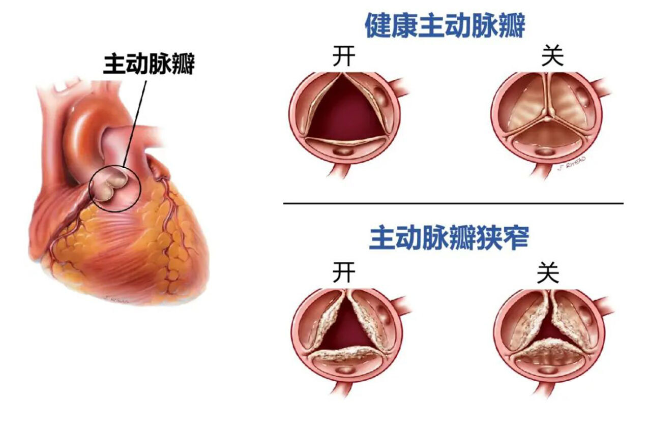 圖文圖片