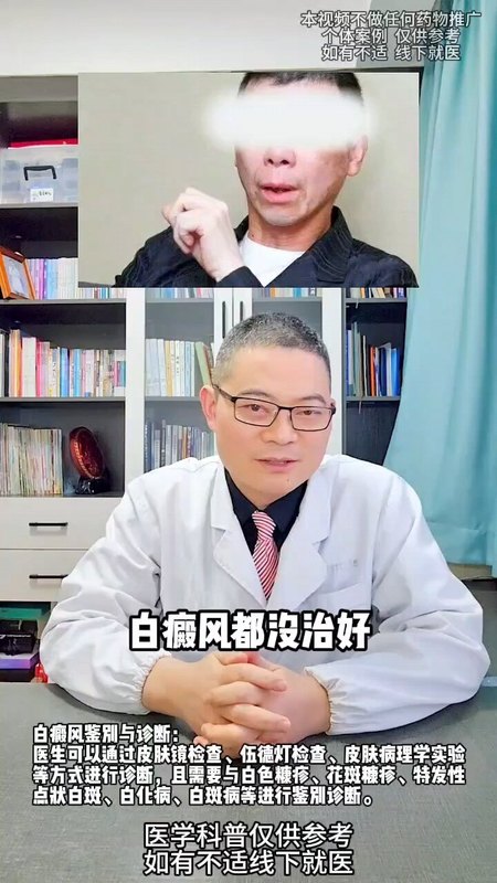 白癜风的新希望！