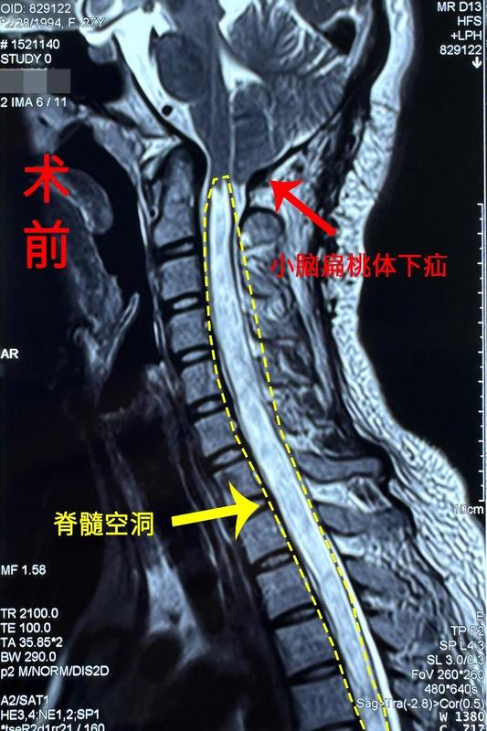 圖文圖片