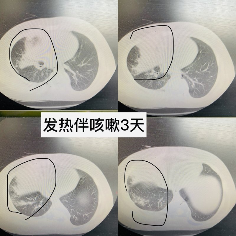 圖文圖片