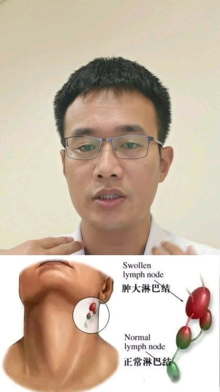 視頻封面