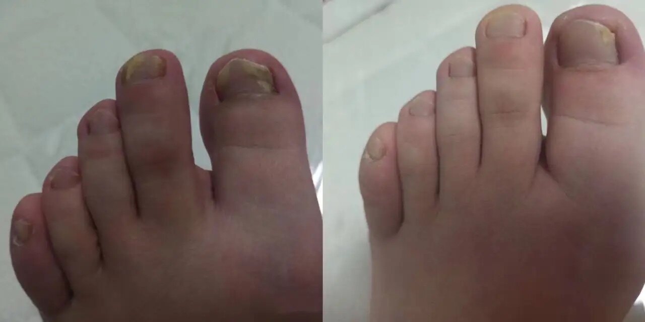 圖文圖片