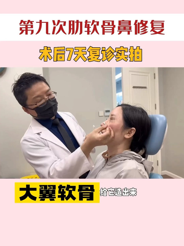 陈付国医生谈：第九次肋软骨鼻修复！（已授权肖像）