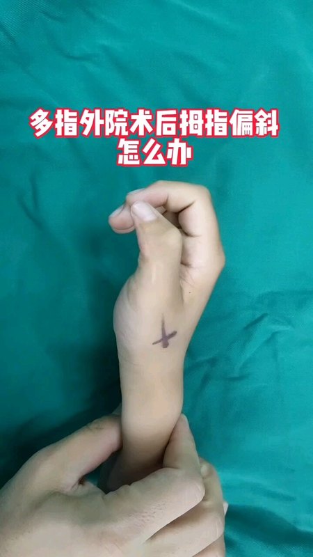 視頻封面